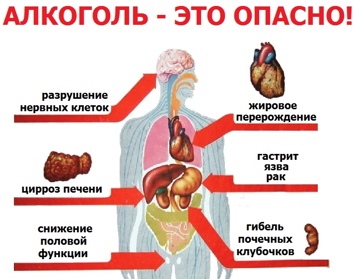 «Жизнь без алкоголя».